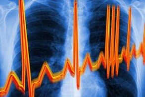 Ang arrhythmia ng puso para sa osteochondrosis
