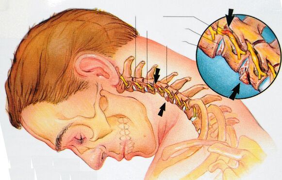 Ang istraktura ng cervical vertebrae