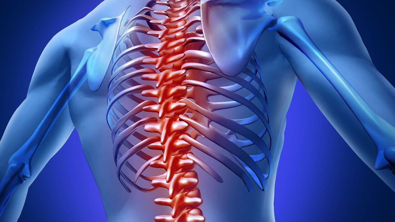 Thoracic osteochondrosis
